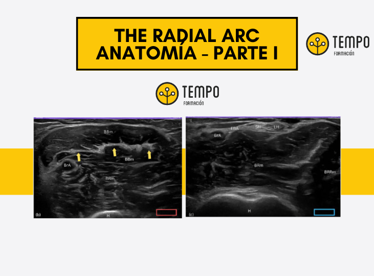 tendon-distal-biceps-parte-i-the-radial-arc